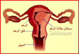 endometrum